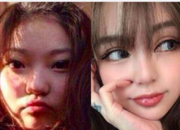 整容脸的网红,揭秘流行趋势背后的秘密